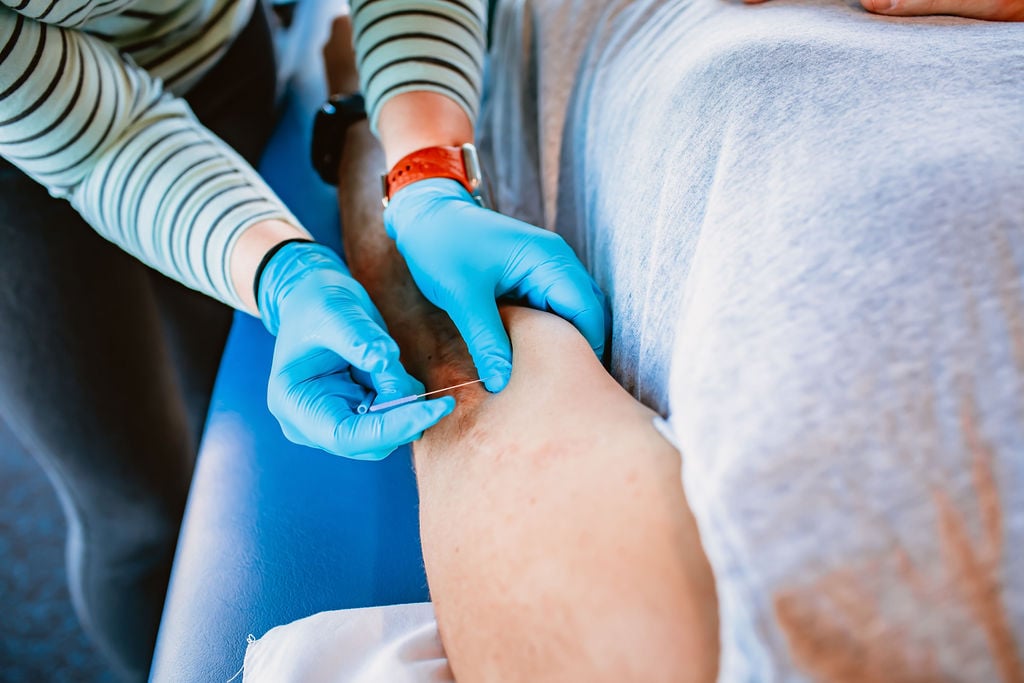 Dry Needling
