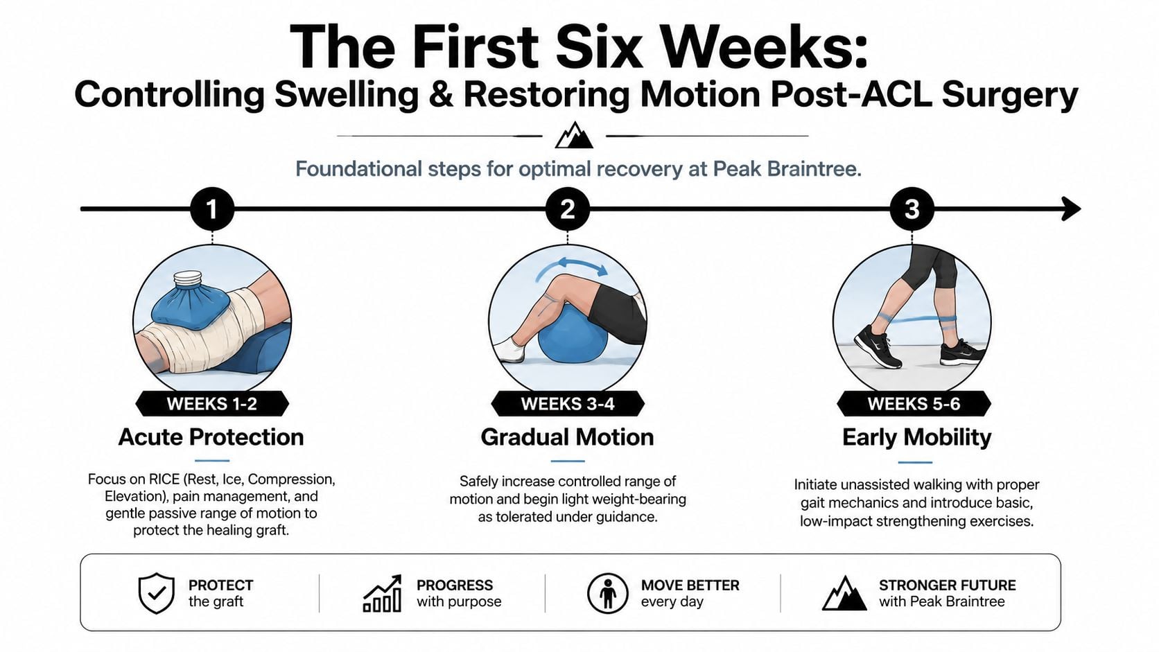 A timeline graphic showing the first six weeks of post-ACL surgery recovery, including protection, motion, and mobility.