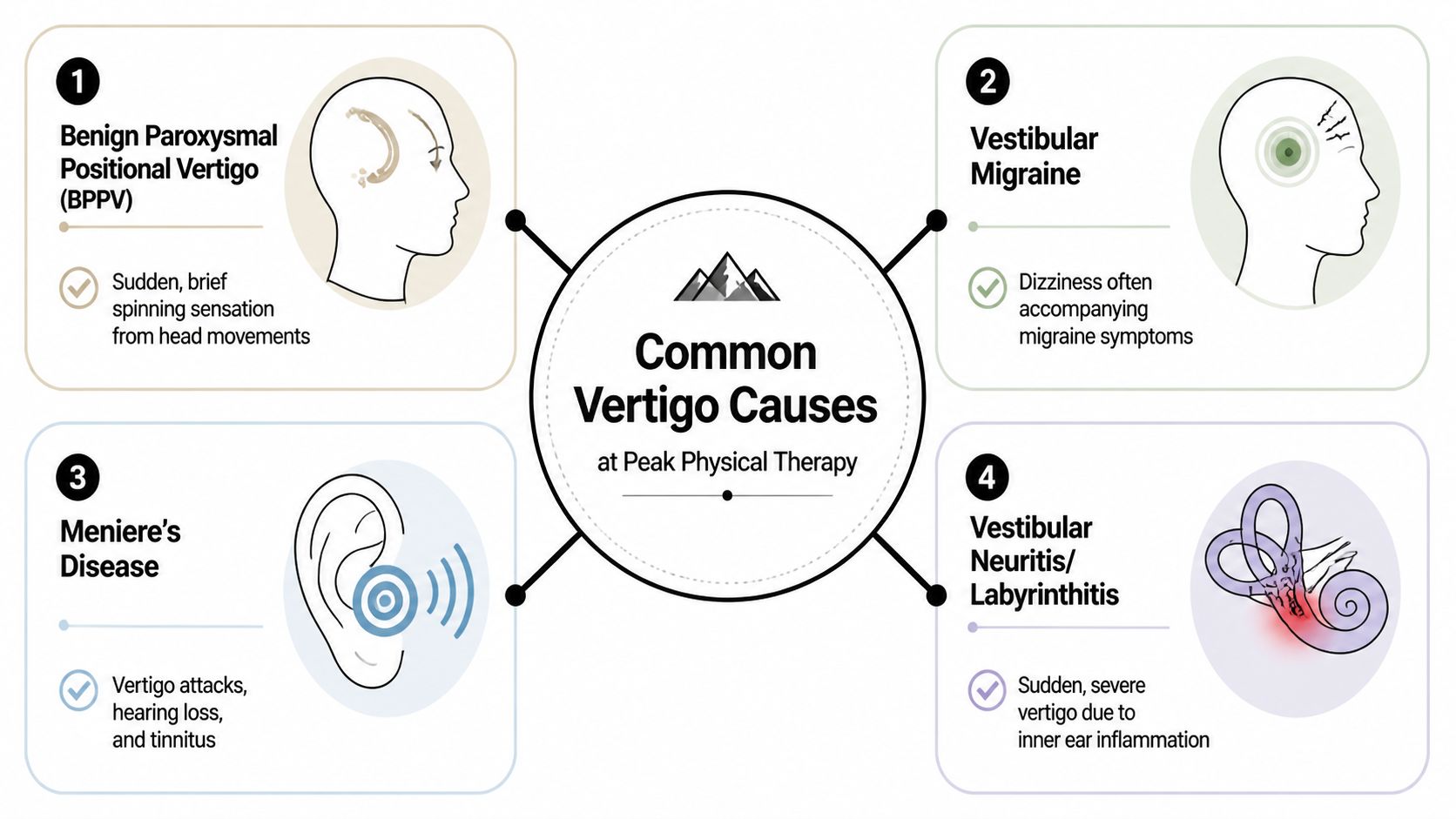 An infographic showing four common causes of vertigo including BPPV, vestibular migraine, Meniere's disease, and labyrinthitis.